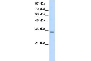 WB Suggested Anti-SNRPA Antibody Titration:  0. (SNRPA1 抗体  (Middle Region))