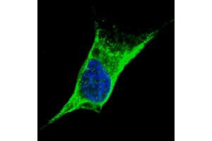 Fluorescent confocal image of SY5Y cells stained with Vimentin (C-term) antibody. (Vimentin 抗体  (C-Term))