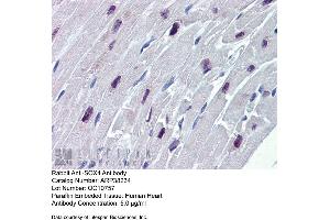 Immunohistochemistry (IHC) image for anti-SRY (Sex Determining Region Y)-Box 4 (SOX4) (N-Term) antibody (ABIN2780469) (SOX4 抗体  (N-Term))