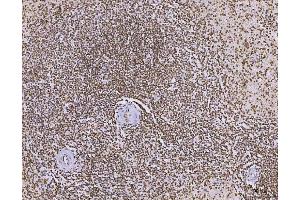 IHC analysis of C1orf77/FOP/CHTOP using anti-C1orf77/FOP/CHTOP antibody (ABIN7603201). (CHTOP 抗体  (N-Term))