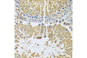 Immunohistochemistry of paraffin-embedded rat testis using PIBF1 Antibody. (PIBF1 抗体)