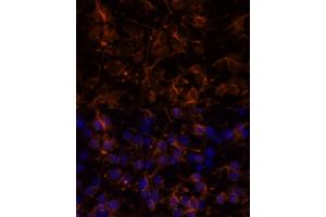 Immunofluorescence (IF) image for anti-Neural Cell Adhesion Molecule 1 (NCAM1) (AA 759-858) antibody (ABIN6144393)