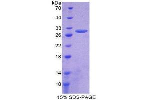 SDS-PAGE (SDS) image for tau Protein (AA 130-386) protein (His tag) (ABIN1878671) (tau Protein (AA 130-386) (His tag))
