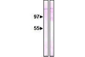 Western Blotting (WB) image for anti-Nucleoporin 153kDa (NUP153) (AA 610-1191) antibody (ABIN2452062) (NUP153 抗体  (AA 610-1191))