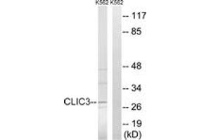 Western blot analysis of extracts from K562 cells, using CLIC3 Antibody. (CLIC3 抗体  (AA 21-70))