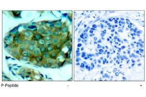 Image no. 1 for anti-Mechanistic Target of Rapamycin (serine/threonine Kinase) (mTOR) (pSer2448) antibody (ABIN196963) (MTOR 抗体  (pSer2448))