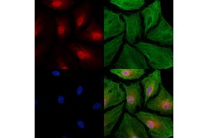ABIN6264131 and ABIN6277486 staining  cells by IF/ICC. (PELP1 抗体  (Internal Region))