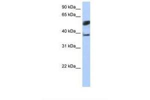 anti-Speckle-Type POZ Protein-Like (SPOPL) (AA 74-123) antibody