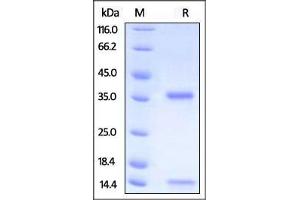 Biotinylated Human FcRn / FCGRT & B2M on SDS-PAGE under reducing (R) condition. (FcRn Protein (AA 24-297) (His tag,Strep Tag,AVI tag,Biotin))