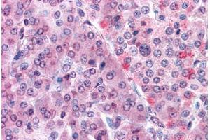 Human Pancreas: Formalin-Fixed, Paraffin-Embedded (FFPE) (Malectin 抗体  (Internal Region))
