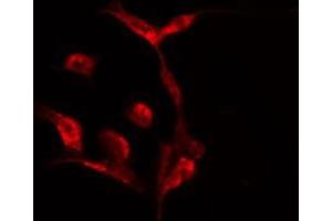 ABIN6275524 staining  HeLa cells by IF/ICC. (Septin 7 抗体  (C-Term))