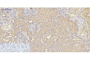 Immunohistochemistry of paraffin-embedded Human kidney tissue using IL8 Polyclonal Antibody at dilution of 1:200. (IL-8 抗体)
