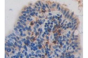 Detection of RNASE3 in Rat Intestine Tissue using Polyclonal Antibody to Ribonuclease A3 (RNASE3) (RNASE3 抗体  (AA 33-155))