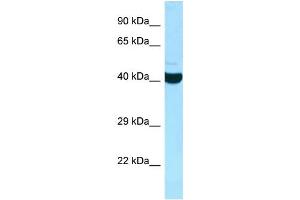 WB Suggested Anti-ADPRHL2 Antibody Titration: 1. (ADPRHL2 抗体  (C-Term))