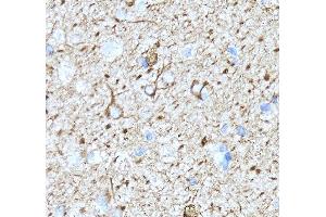 IHC analysis of Alpha Internexin/INA using anti-Alpha Internexin/INA antibody (ABIN7602187).