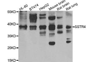 Western blot analysis of extracts of various cell lines, using SSTR4 antibody (ABIN5975458) at 1/1000 dilution. (SSTR4 抗体)