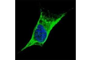 Fluorescent confocal image of SY5Y cells stained with anti-Vimentin antibody at 1:100.