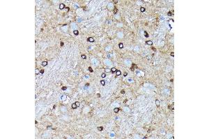 Immunohistochemistry of paraffin-embedded rat brain using Argonaute-2 antibody (ABIN7265671) at dilution of 1:100 (40x lens). (AGO2 抗体)