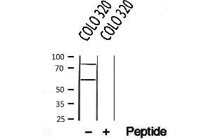 Western blot analysis of extracts from COLO 320, using CREB3L1,OASIS antibody. (CREB3L1 抗体  (N-Term))