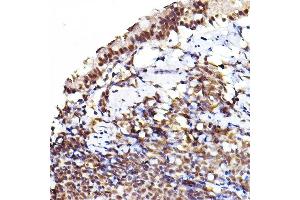 Immunohistochemistry of paraffin-embedded rat lung using Phospho--S473+-S474+-S472 Rabbit pAb (ABIN7265523) at dilution of 1:100 (40x lens). (AKT 1/2/3 抗体  (pSer472))