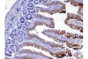 IHC analysis of UGT1A1 using anti-UGT1A1 antibody . (UGT1A1 抗体  (AA 316-533))