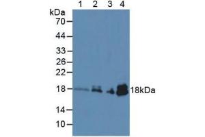 Figure. (TNNC1 抗体  (AA 1-161))