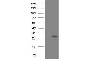 Western Blotting (WB) image for anti-Sepiapterin Reductase (SPR) antibody (ABIN1501116) (SPR 抗体)