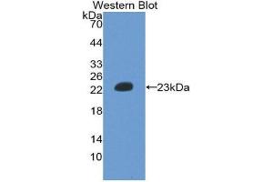 Western Blotting (WB) image for anti-Hemoglobin beta (HBB) (AA 1-147) antibody (ABIN2116576) (Hemoglobin Subunit beta 抗体  (AA 1-147))