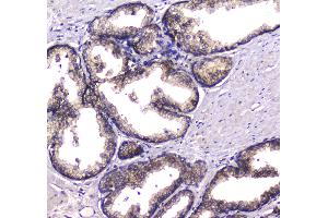 IHC analysis of HGD using anti-HGD antibody . (HGD 抗体  (AA 374-445))