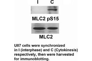 Western Blotting (WB) image for anti-Myosin Regulatory Light Chain 2, Smooth Muscle Isoform (MYL9) (pSer15) antibody (ABIN7138433)