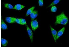 IF analysis of SND1 using anti-SND1 antibody (ABIN7600525). (SND1 抗体  (AA 20-204))