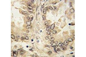 Immunohistochemistry (IHC) image for anti-SRY (Sex Determining Region Y)-Box 2 (SOX2) (AA 89-119) antibody (ABIN3032736)