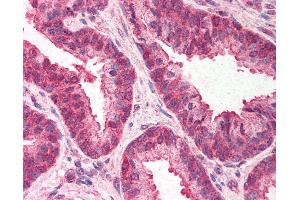 Anti-TMED10 / TMP21 antibody IHC of human prostate. (TMED10 抗体  (C-Term))