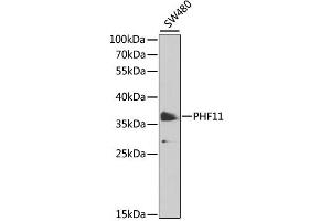Western blot analysis of extracts of SW480 cells, using PHF11 antibody (ABIN6290738) at 1:1000 dilution. (PHF11 抗体)
