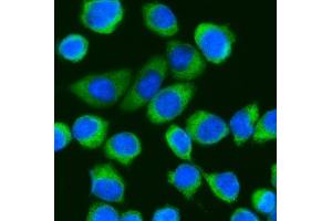 IF analysis of DDX3 using anti-DDX3 antibody (ABIN5518905).