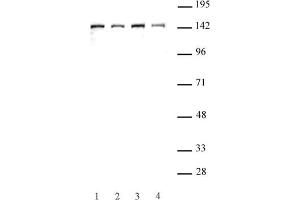 SMC3 antibody (pAb) tested by Western blot. (SMC3 抗体  (C-Term))