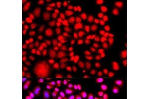 Immunofluorescence analysis of A549 cells using TESK2 Polyclonal Antibody (TESK2 抗体)