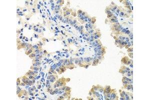 Immunohistochemistry of paraffin-embedded Mouse lung using LRG1 Polyclonal Antibody at dilution of 1:100 (40x lens).