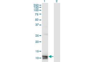 Western Blot analysis of MLN expression in transfected 293T cell line by MLN monoclonal antibody (M07), clone 4E12. (Motilin 抗体  (AA 1-115))