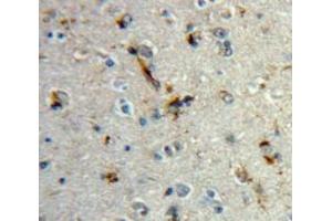 Used in DAB staining on fromalin fixed paraffin-embedded Brain tissue (MBP 抗体  (AA 18-222))