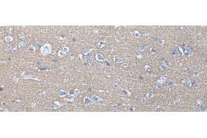 Immunohistochemistry of paraffin-embedded Human brain tissue using ETFB Polyclonal Antibody at dilution of 1:40(x200) (ETFB 抗体)