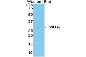 Western blot analysis of the recombinant protein. (MIB2 抗体  (AA 687-930))
