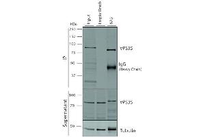 Immunoprecipitation analysis using Mouse Anti-VPS35 Monoclonal Antibody, Clone 8A3 (ABIN6932977). (VPS35 抗体  (PerCP))