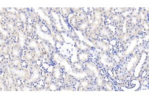 Detection of LBP in Rat Kidney Tissue using Polyclonal Antibody to Lipopolysaccharide Binding Protein (LBP)