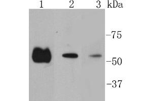 Lane 1: Hela lysates, Lane 2:A431 lysates, Lane 3: PC12 lysates probed with Smad2 (9A3) Monoclonal Antibody  at 1:1000 overnight at 4˚C. (SMAD2 抗体)