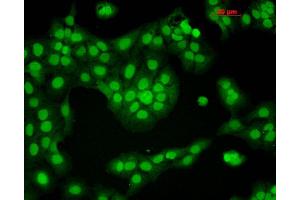 Immunocytochemistry/Immunofluorescence analysis using Mouse Anti-CaMKII Monoclonal Antibody, Clone 6G9 . (CAMKII gamma 抗体  (FITC))
