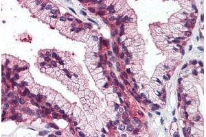 Anti-SLC39A14 antibody  ABIN960809 IHC staining of human prostate. (SLC39A14 抗体  (Cytoplasmic Domain))