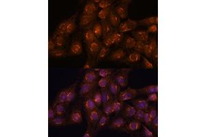 Immunofluorescence analysis of C6 cells using  antibody (ABIN7265416) at dilution of 1:100. (ACBD3 抗体  (AA 1-160))
