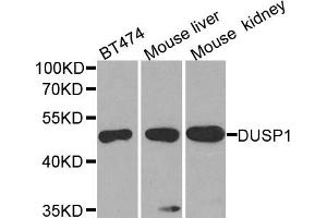 Western blot analysis of extracts of various cell lines, using DUSP1 antibody. (DUSP1 抗体)