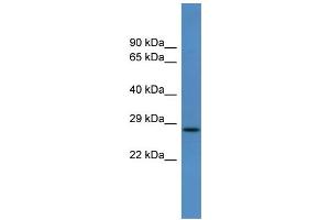 WB Suggested Anti-Caly Antibody Titration:  0.